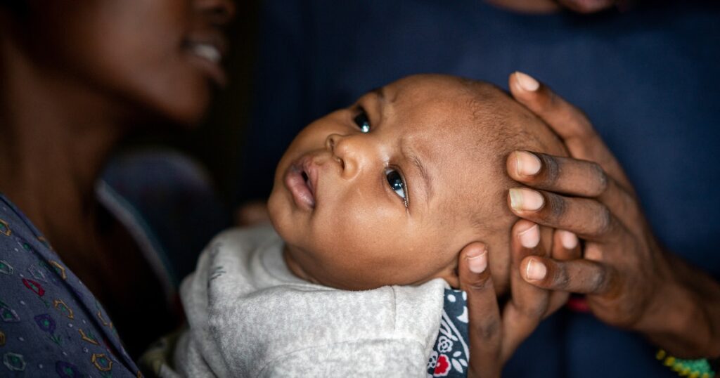 Ce que les parents peuvent (et ne peuvent pas) apprendre des formes de tête étranges des bébés