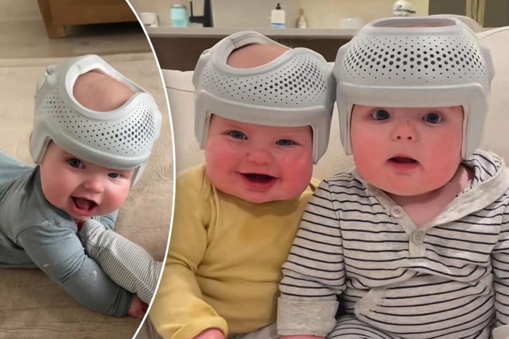 Mes bébés jumeaux portent des casques à 700 $ 23 heures par jour pour remodeler leur tête plate. Ceux qui me détestent disent que je suis « fou », mais c'est pour leur bien.