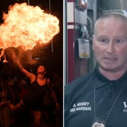 Un adolescent grièvement brûlé alors qu&rsquo;il tentait un défi de « cracheur de feu »