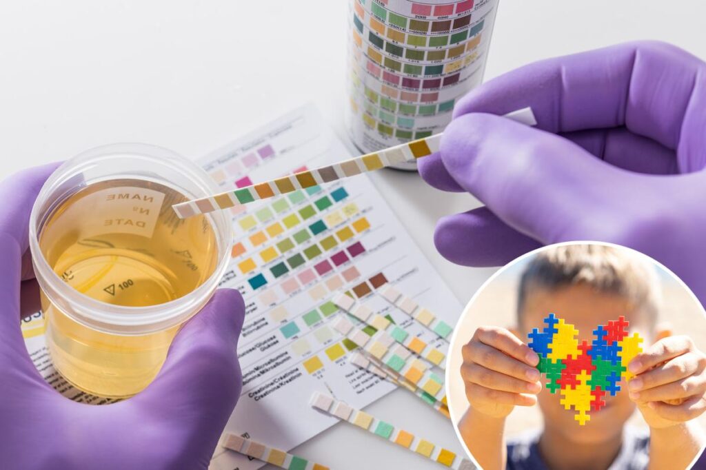 Un nouveau test d'urine pourrait diagnostiquer l'autisme chez les enfants (étude)
