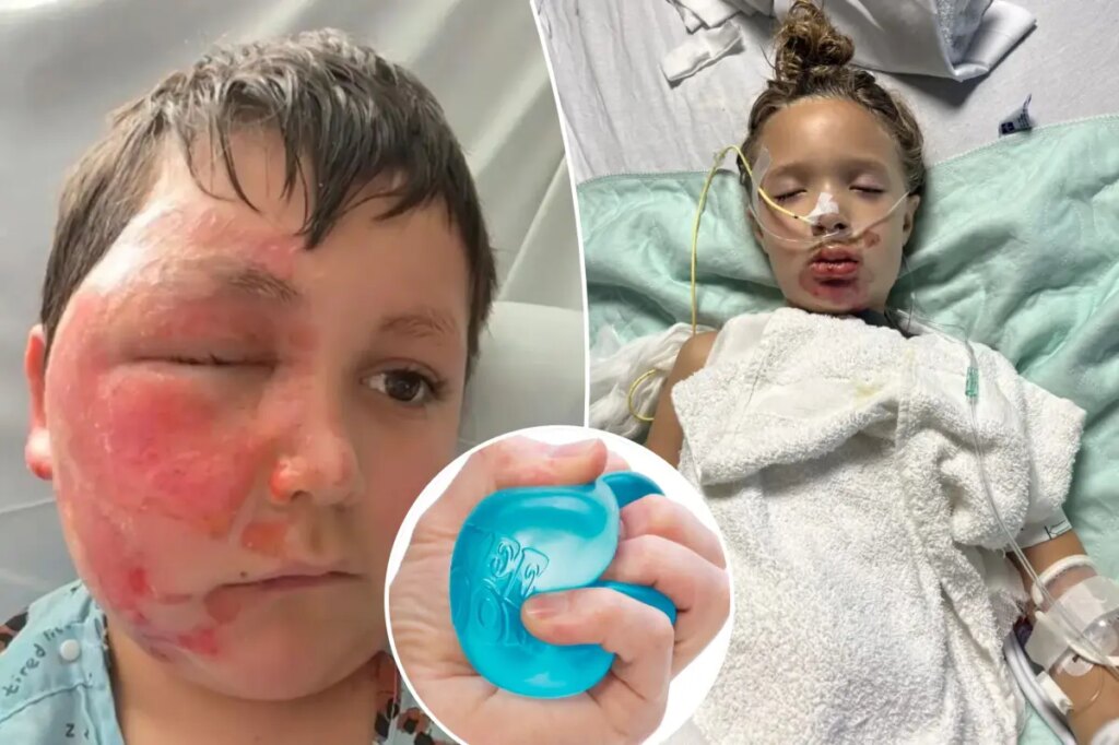 Un médecin prévient que la tendance virale des jouets NeeDoh consiste à hospitaliser des enfants gravement brûlés